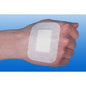 Steriles Inselpflaster auf Hand