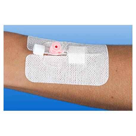RUDAVEN®-plus Kanülenfixierpflaster auf Arm angebracht, schützt Venenverweilkanüle zuverlässig und verhindert Aufrollen.